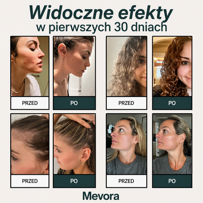 Ocal swoją skórę, swoje włosy i swoje zdrowie przed katastrofą dzięki Mevora™