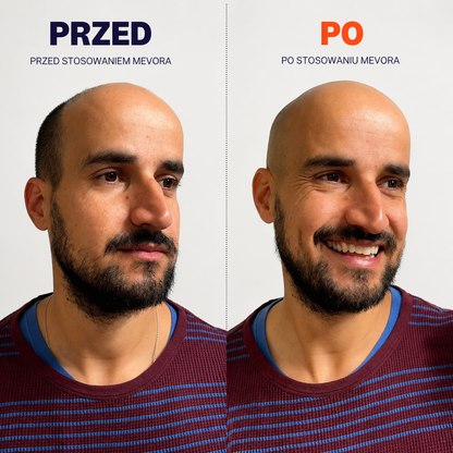 MevoraFlex® Zestaw do golenia